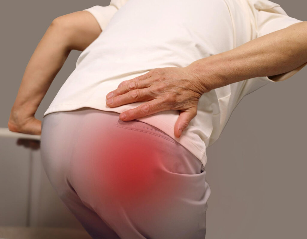 久坐屁股痛怎麼辦？圖解屁股痛位置與常見原因，助你找回久坐舒適感